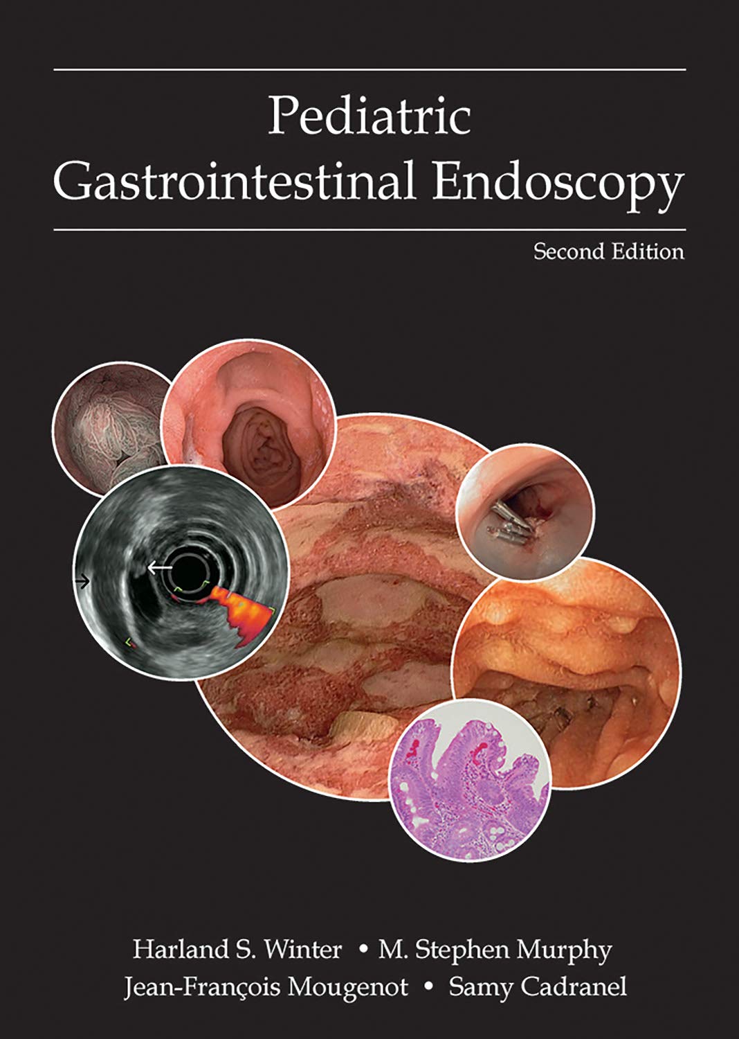 Pediatric Gastrointestinal Endoscopy, 2nd Edition | Εκδόσεις Κωνσταντάρας