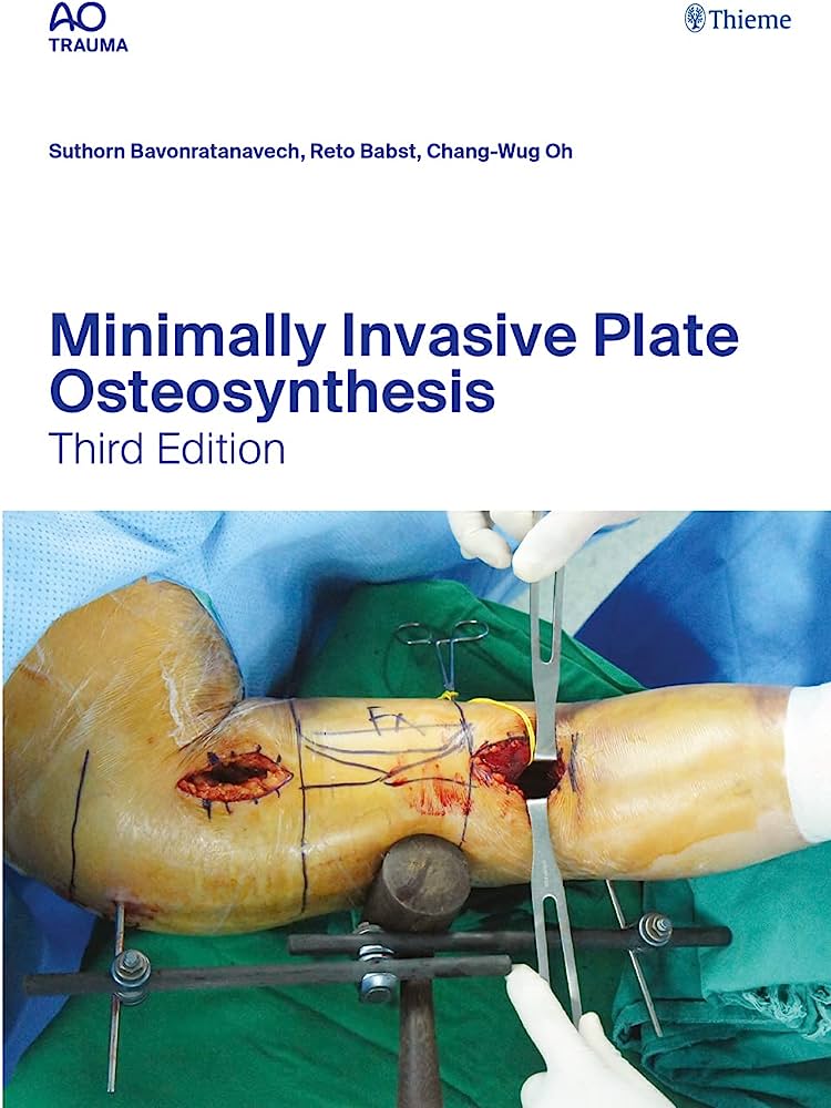 Plate　Minimally　Osteosynthesis　Invasive　Κωνσταντάρας