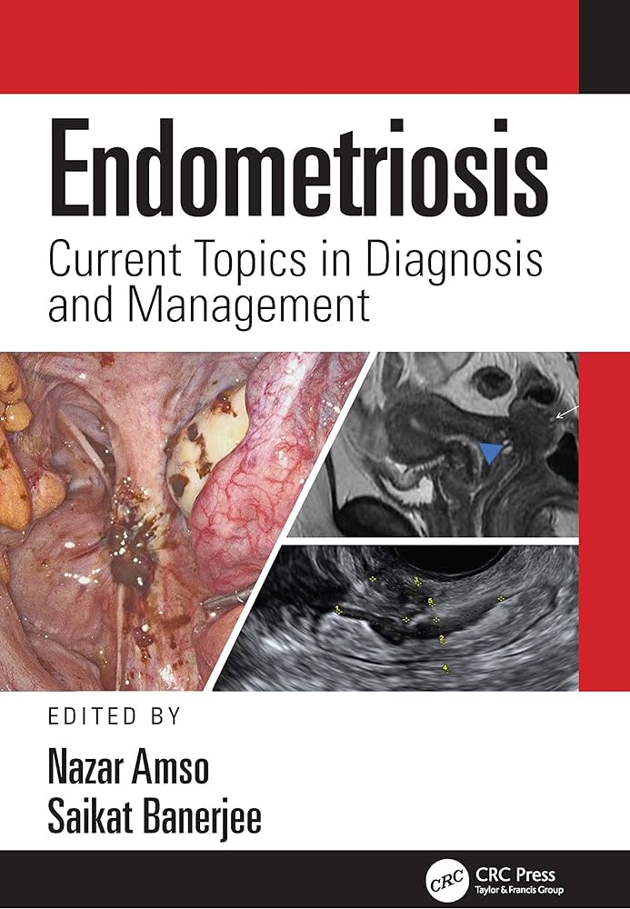 Endometriosis Current Topics In Diagnosis And Management 1st Edition ...